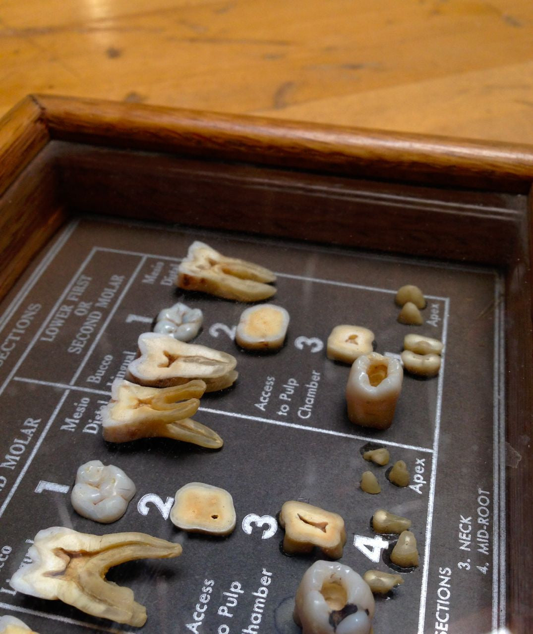 Tooth Dissection