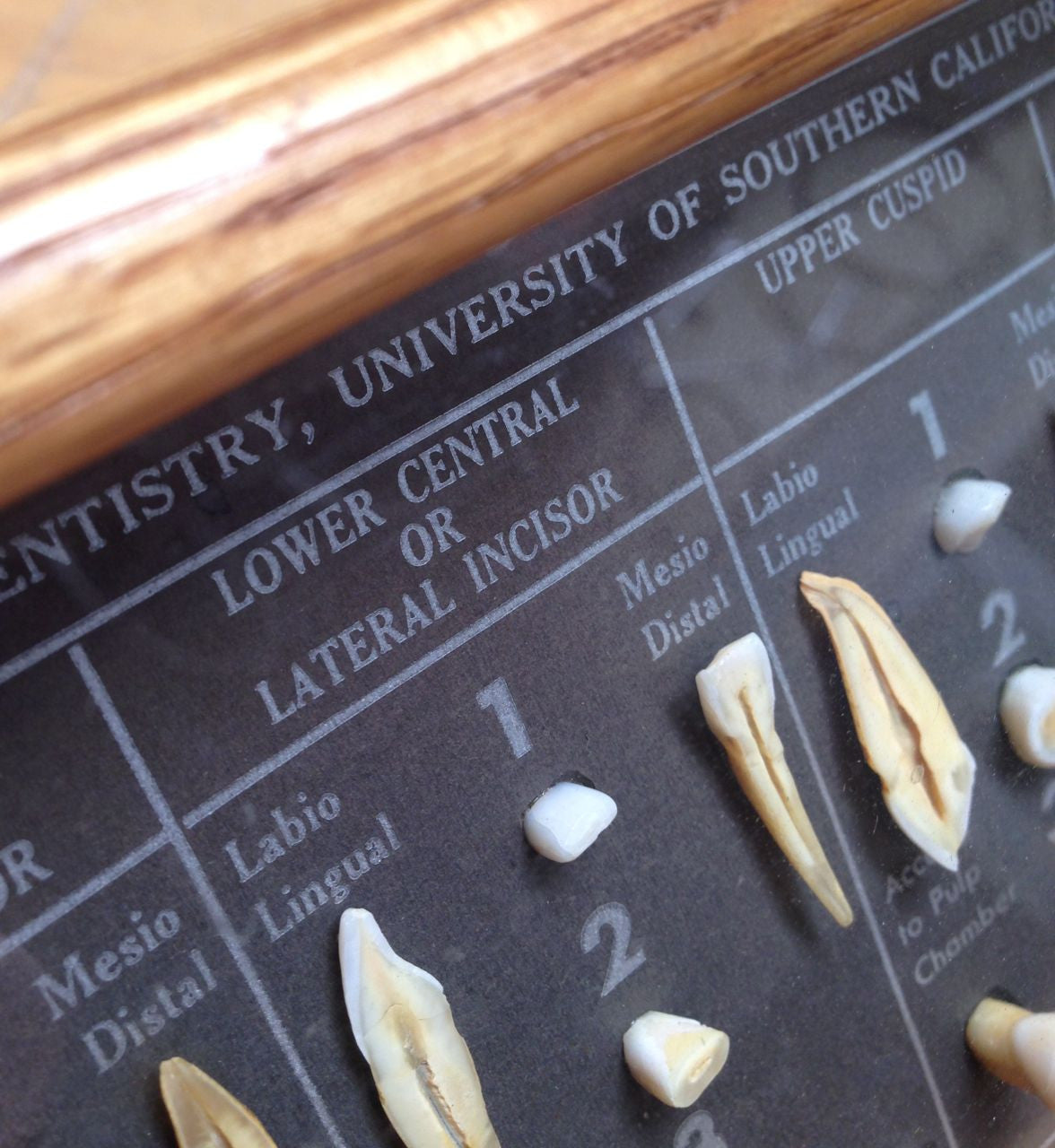 Tooth Dissection