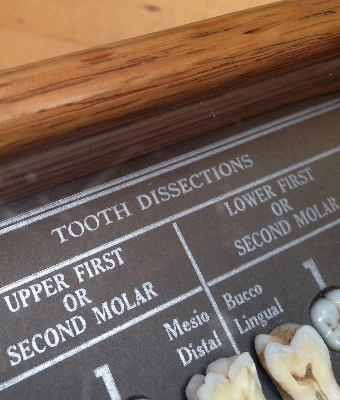 Tooth Dissection