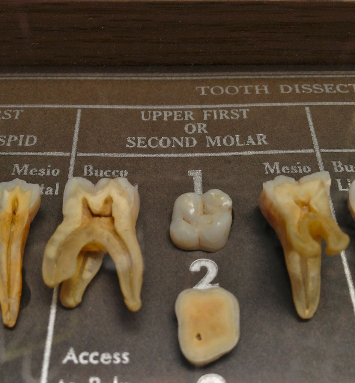 Tooth Dissection